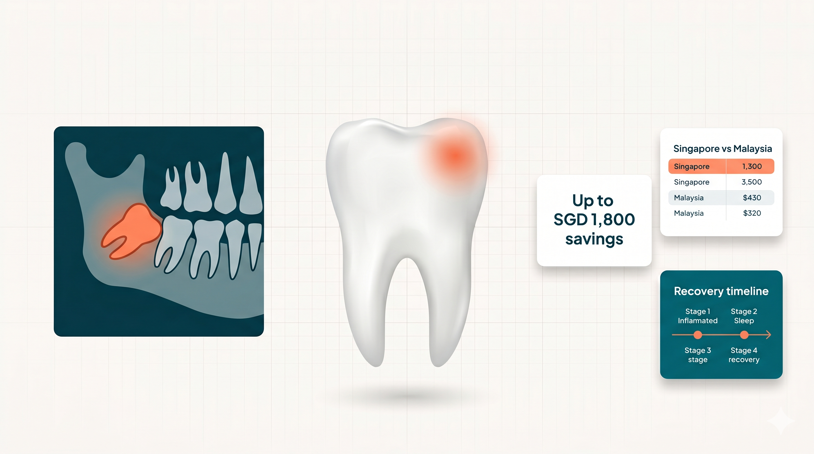 Wisdom tooth removal cost guide for JB — savings, prices, and what to expect